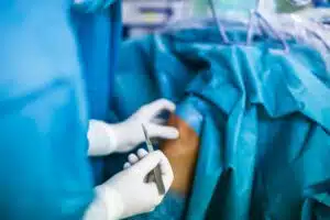 Knee surgery, Orthopedic Operation -surgeons performing a knee surgery on a patient (shallow DOF; color toned image)