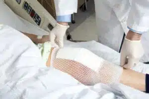 Surgeon Placing Bandage after Knee Surgery