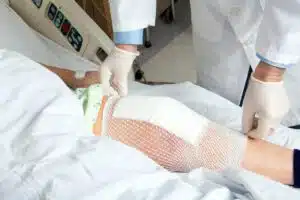 Knee replacement bandage